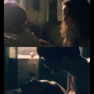 skins